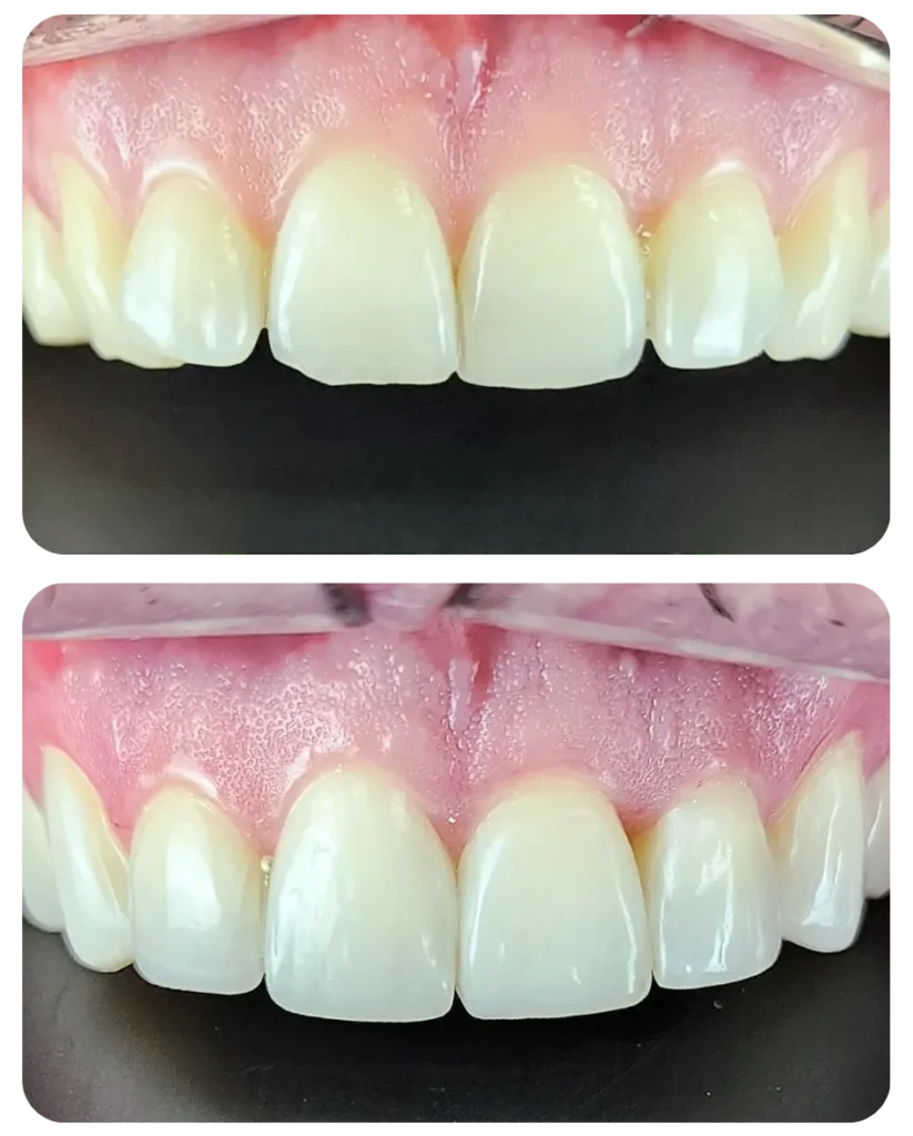Correção da cor e formato. Agora com aspecto mais natural e bonito.