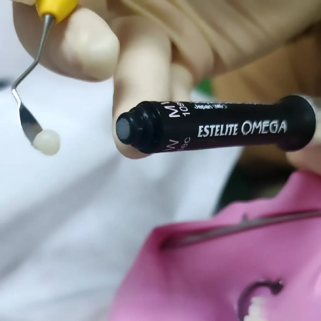 Resina composta para facetas de resina, lentes de resina - Dra. Lígia Spada - Santa Bárbara DOeste